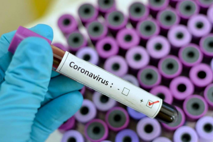 coronavirus